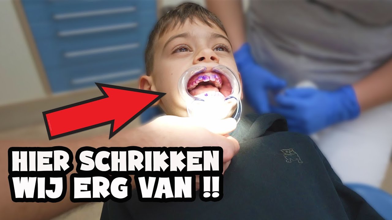 WIJ MOETEN NAAR DE TANDARTS ! - De Bakkertjes #629