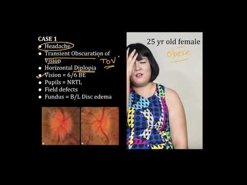 High Yield Topic : Papilledema - A Complete Review
