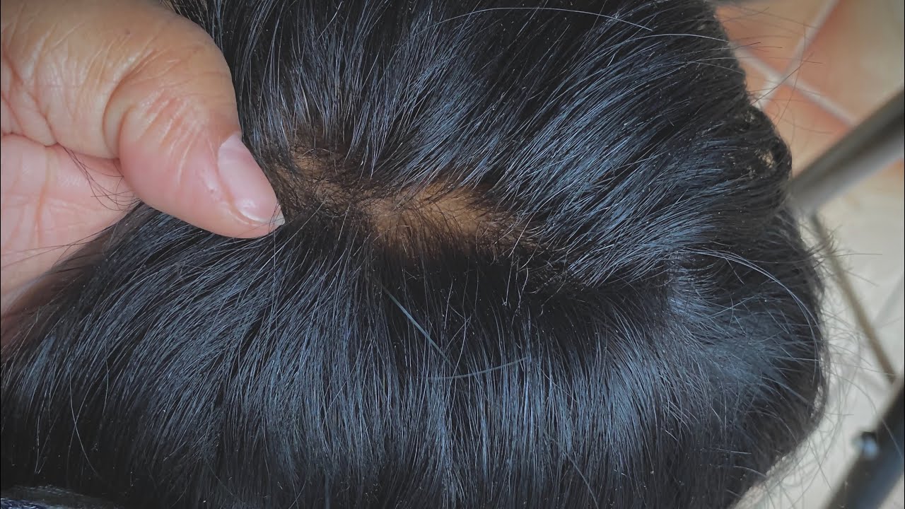 Fake  scalp,silk top como fazer e deixar a lace mais natural