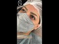 روند ریمو ابرو روند ریمو ابرو