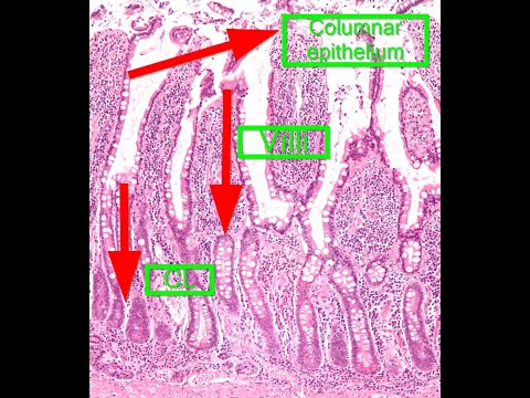 Small and Large Intestine Histology slide | Brunner&rsquo;s glands, Peyer&rsquo;s patches | Med Madness
