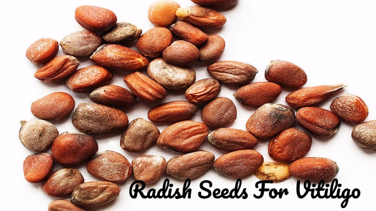 25 Home Remedy to Cure Vitiligo Remedy 2 Radish Seeds YouTube