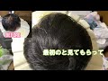 【スーパーミリオンヘアー】薄毛で悩んでいるヒデキンさんがSMH使ってみた！