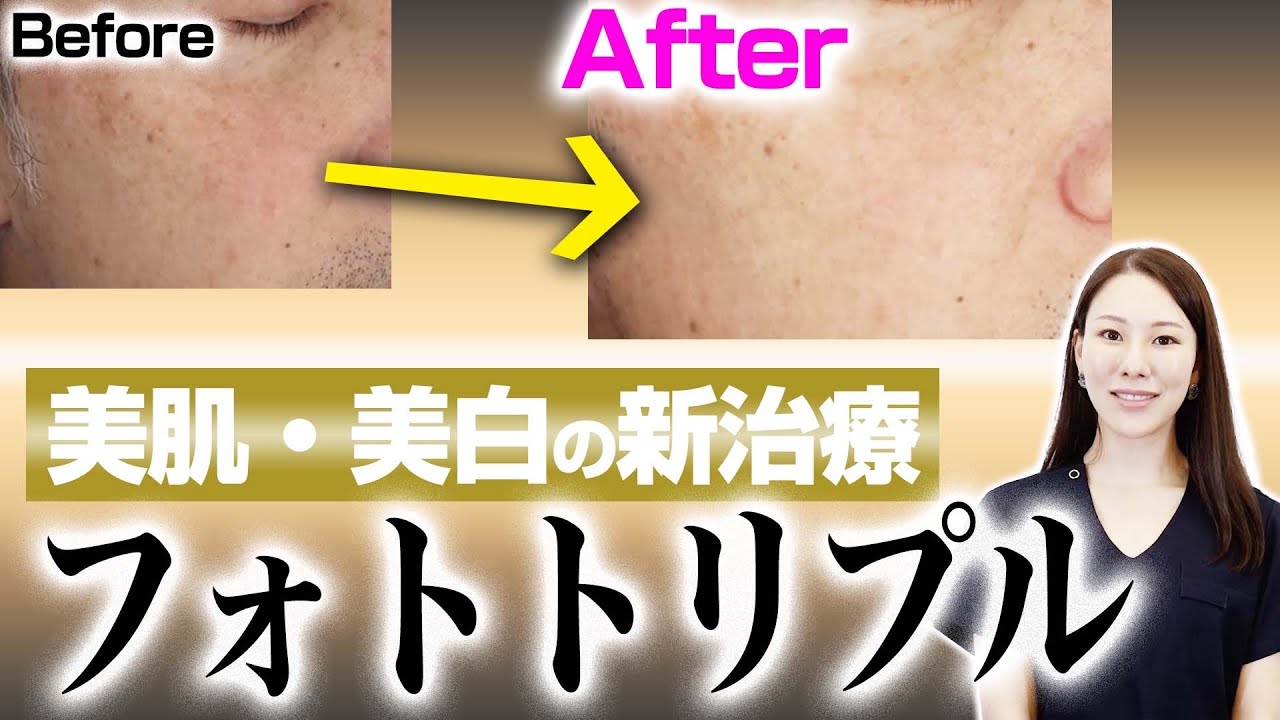 New treatment] A thorough explanation of Photo Triple. - YouTube