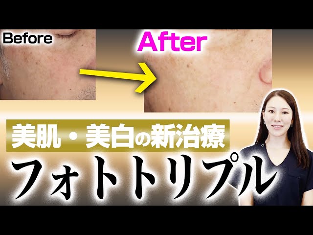 New treatment] A thorough explanation of Photo Triple. - YouTube