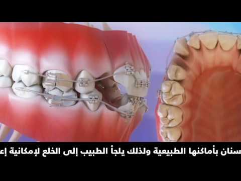 التقويم التقليدي مع خلع اليوتيوب