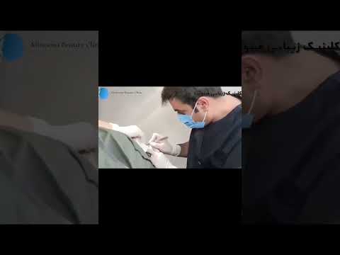 جراحی پلک فوقانی جراحی بلفاروپلاستی بهترین جراح زیبایی یزد