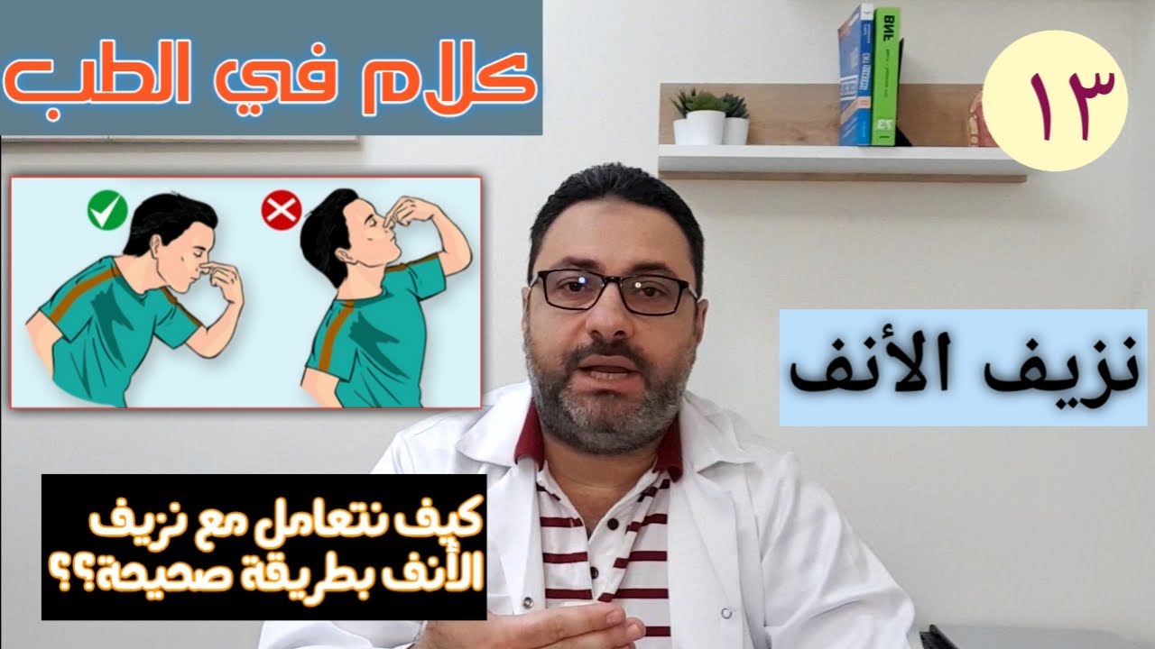 نزيف الأنف Epistaxis