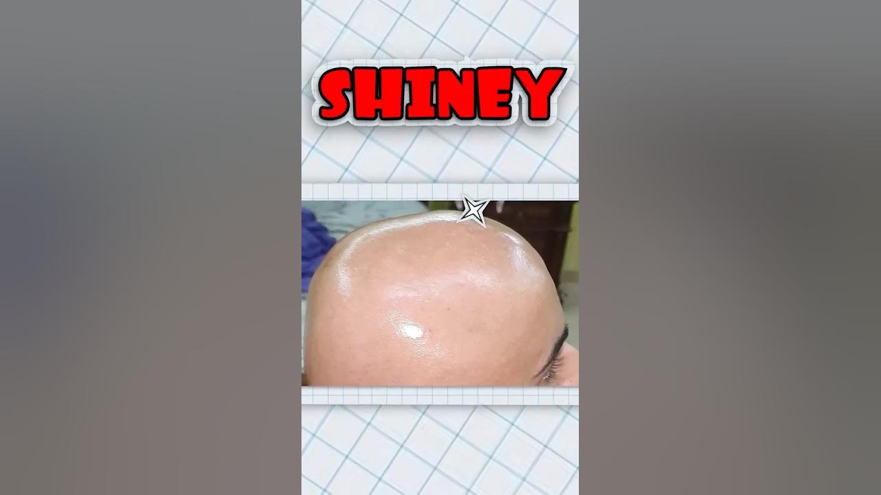why-bald-people-have-shiny-heads-youtube