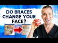 How Braces Change Your Face | Dr. Nate Orthodontist