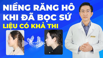 Niềng Răng Hô Khi Đã Bọc Sứ - Liệu Có Khả Thi | Nam Bùi Vinalign
