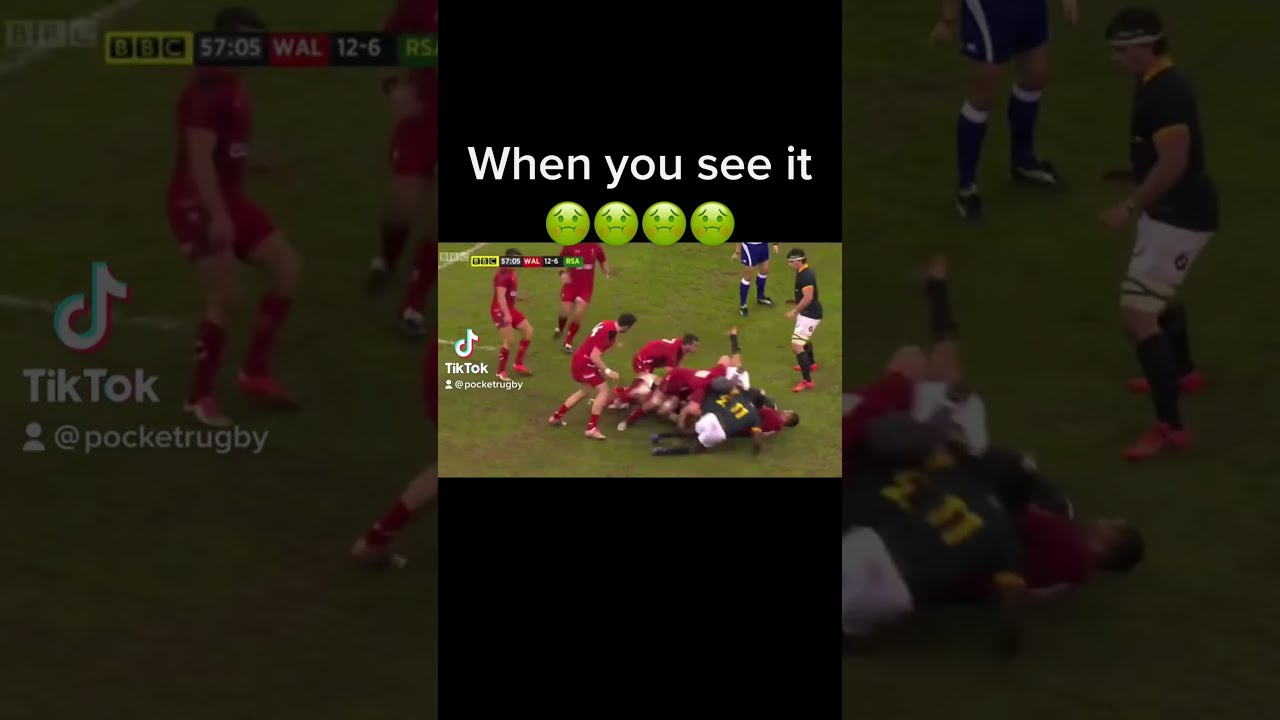 You Can T Unsee This Rugby Rugbyhits Animal Sport Rugbyfans Injury Acl