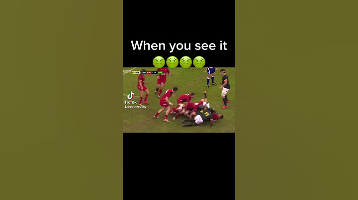 You can’t unsee this 🤢😭 #rugby #rugbyhits #animal #sport #rugbyfans #injury #acl