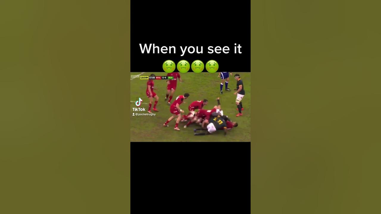 You can’t unsee this 🤢😭 #rugby #rugbyhits #animal #sport #rugbyfans #injury #acl