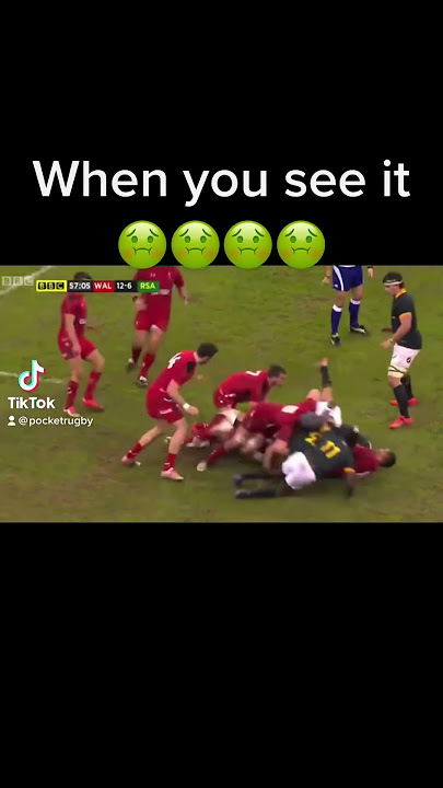 You can’t unsee this 🤢😭 #rugby #rugbyhits #animal #sport #rugbyfans #injury #acl