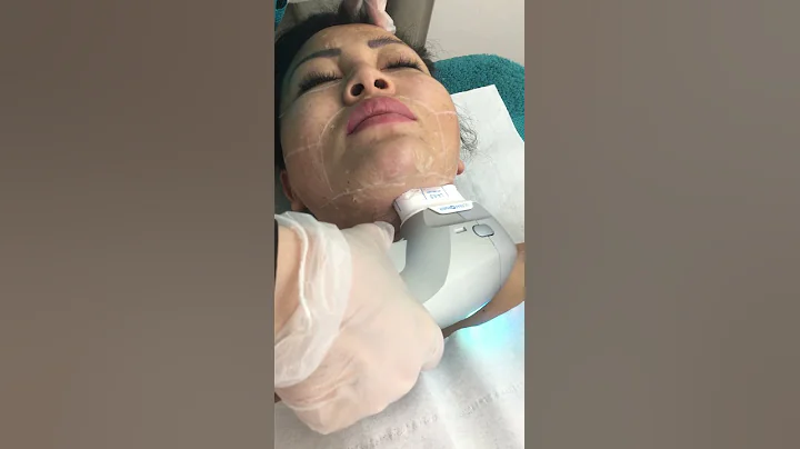 我在英國倫敦做超聲刀雙下巴去除及全臉緊緻提升，為了美，疼痛卻能忍受 - 天天要聞