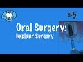 Oral Surgery | Implants | NBDE Part II