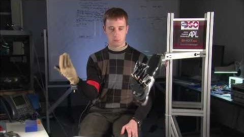 Modular Prosthetic Limb