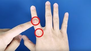 How to Remember Rheumatoid vs. Osteoarthritis Hand Joint Involvement