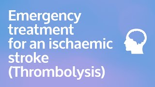 Emergency treatment for an ischaemic stroke (Thrombolysis) screenshot 4