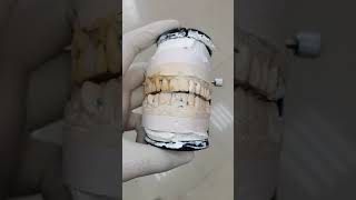 Диоксид циркония #shirts #shortsvideo #dentaltechnician #dentist #зубнойтехник #стоматология