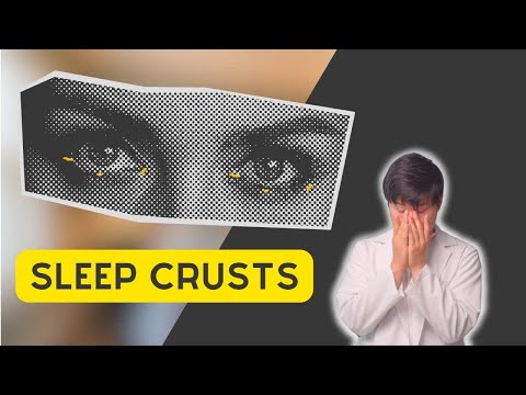 Sleep crusts: what you didn't know about