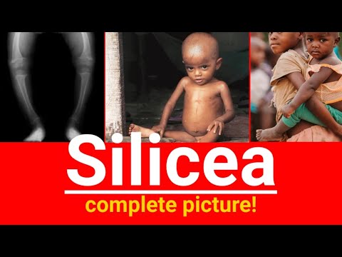 Silicea homeopathic medicine | Silicea complete picture | In which potency silicea is used for boil?
