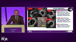 Left main and bifurcations: latest clinical data applied to practical cases - EuroPCR 2023