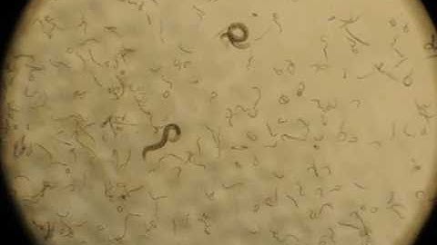 Cryotronic Freezing of C. elegans