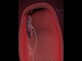 Placenta Delivery 3D Animation Placenta Delivery 3D Animation