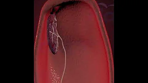 Placenta Delivery  ( 3D Animation)