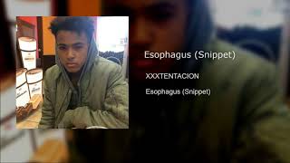 Esophagus (Snippet)