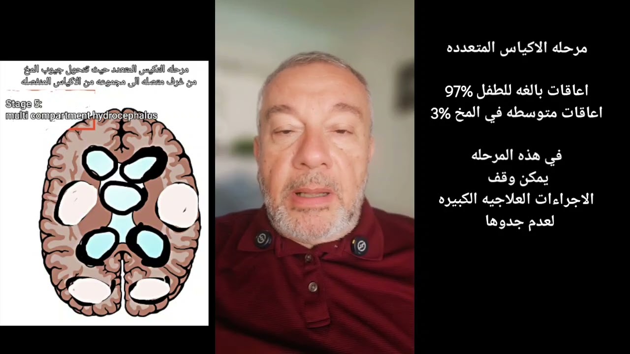 التهاب المخ في اطفال الحضانات، شرح لمراحل الالتهاب، وعرض للجديد في علاج الالتهاب