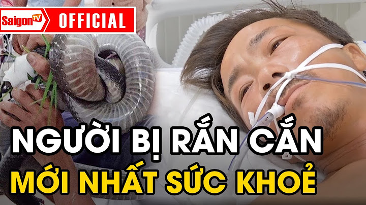 Sức khỏe người đàn ông bị RẮN ĐỘC cắn ở Tây Ninh Mới Nhất 27/08