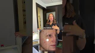 Bbl Forever Clear For Acne Dr. Garramone