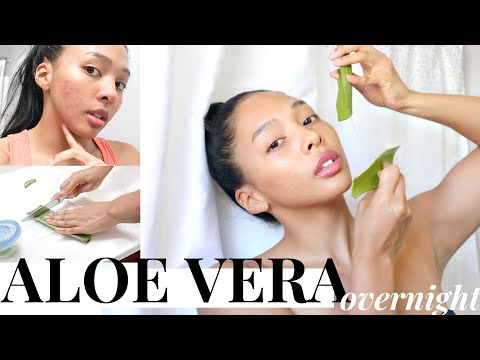 I used fresh ALOE VERA for acne & dark spots...This is what happened!! - pt. 1 | Pamela Ross