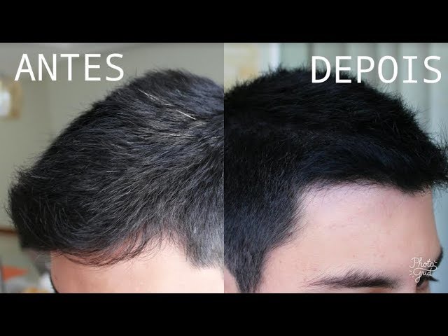 cabelo branco masculino jovem