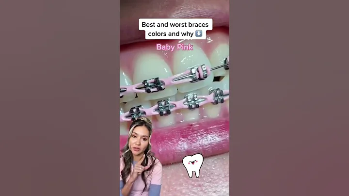 Best/Worst Braces Colors-Baby Pink on Teeth
