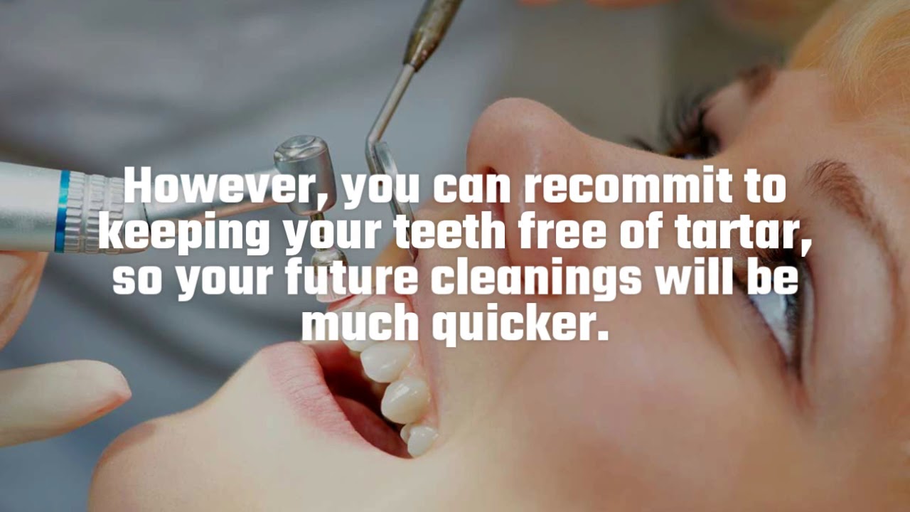 How Davao Dentists Remove Plaque 2019  [DentalExpertPH] 720p