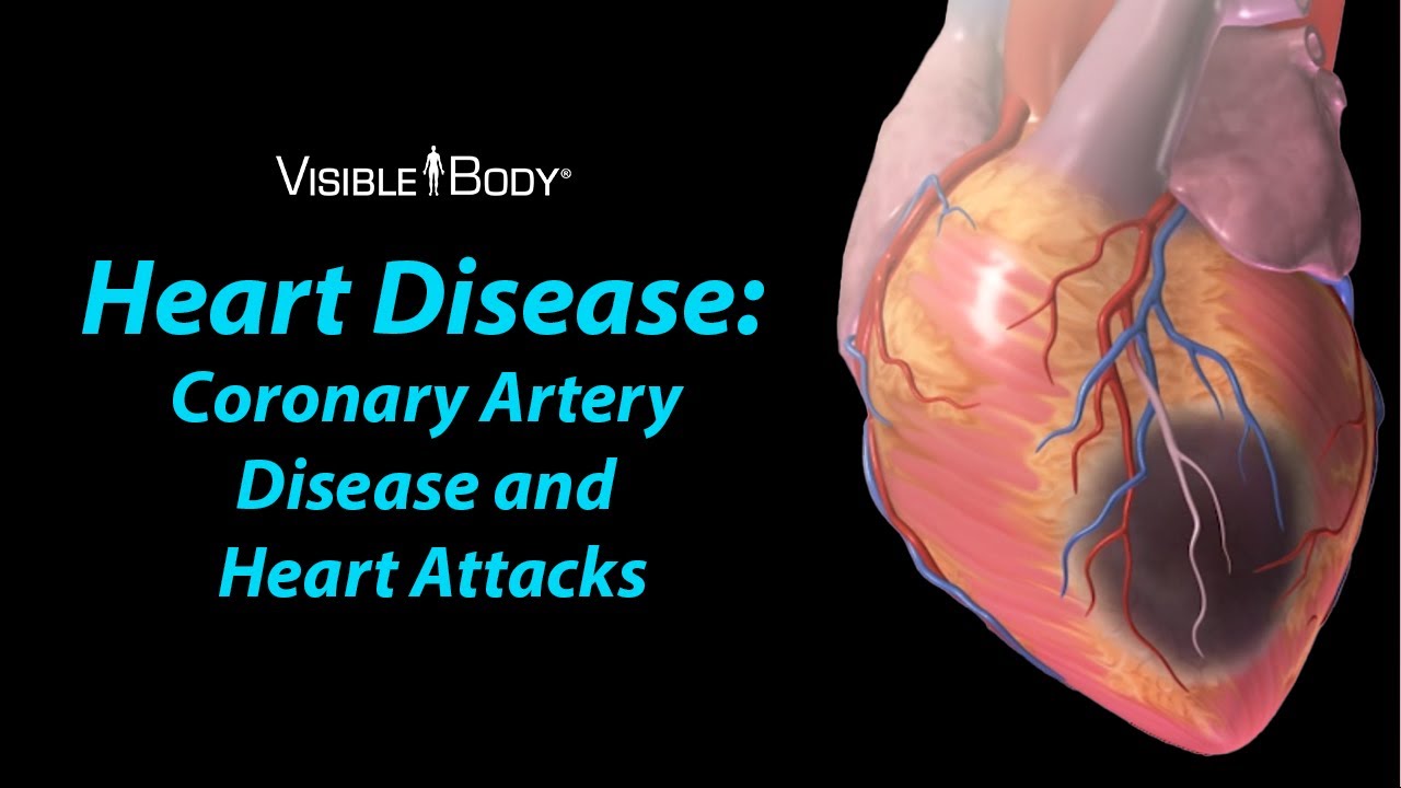 diseased human heart