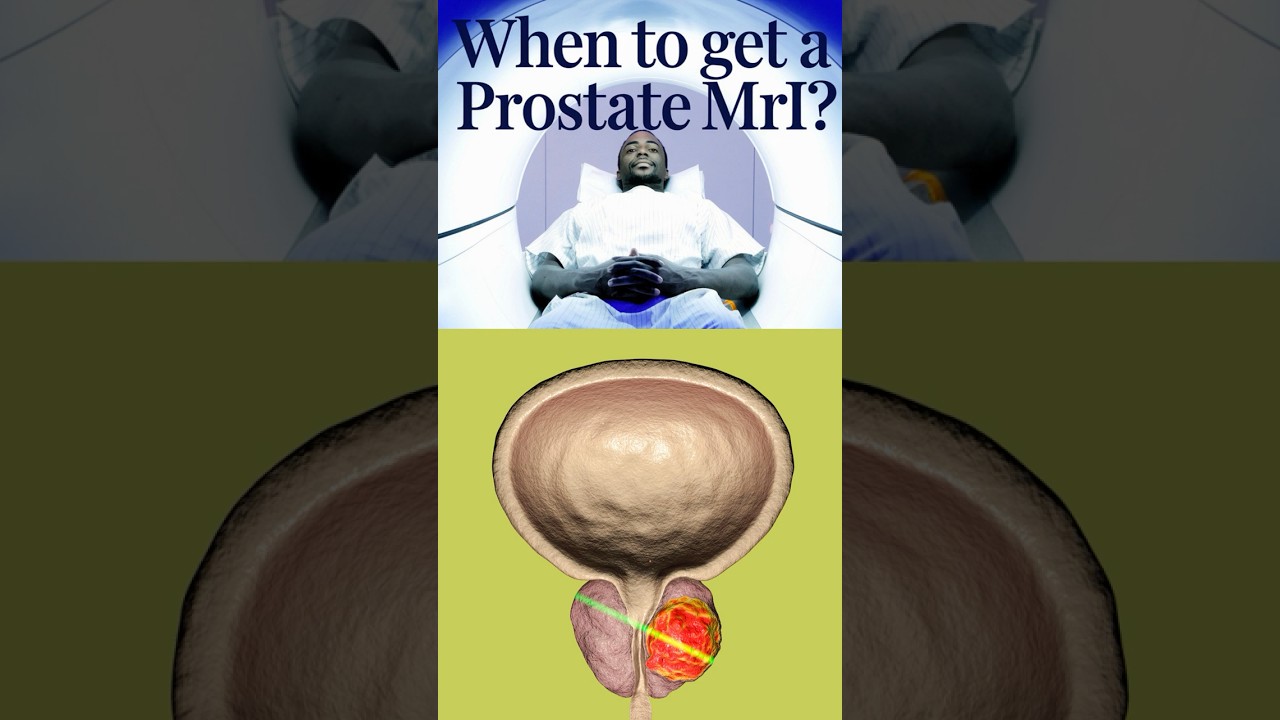 When to get a PROSTATE MRI Scan 