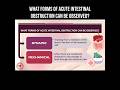 What forms of acute intestinal obstruction can be observed? #intestine #intestinalobstruction #pain