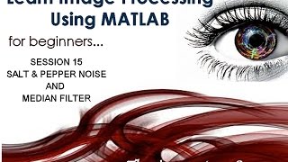 Median filter to remove Salt & Pepper noise