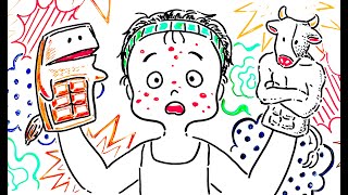 牛乳よりもチョコレートの方がモテ肌になる理由を解説