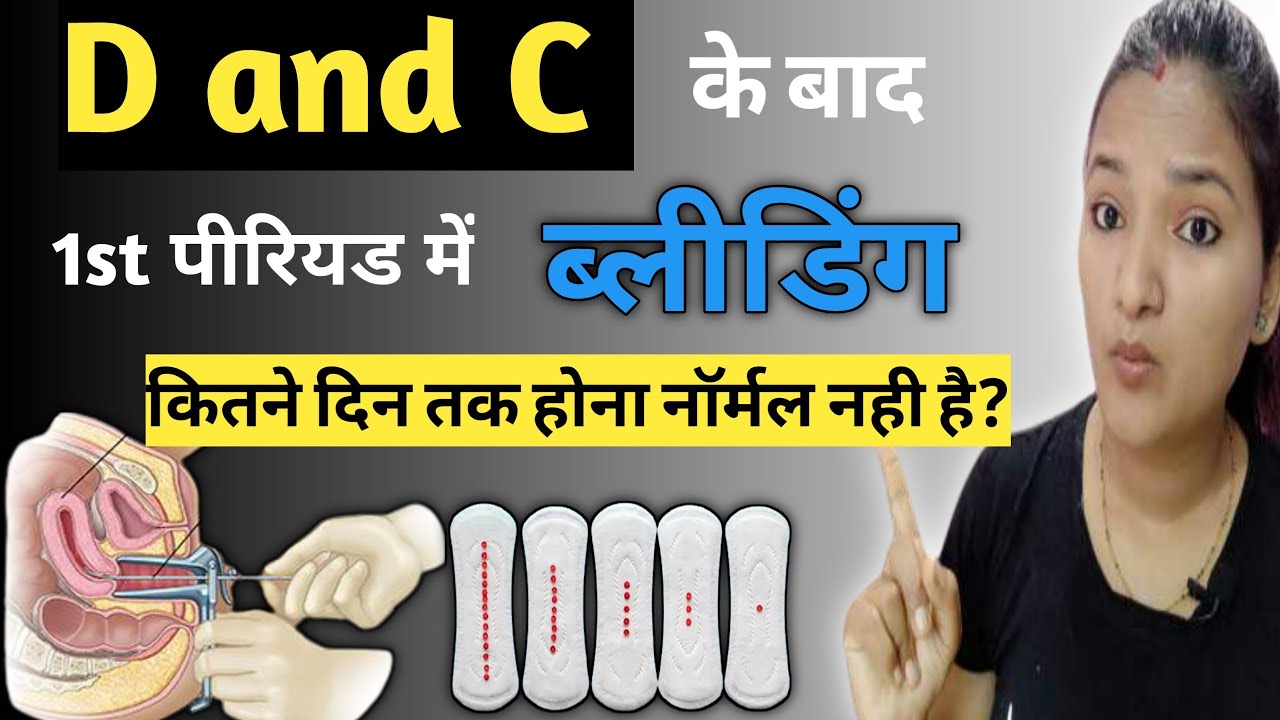 D And C Ke Baad 1st Period Mai Bleeding Kitne Din Tak Hoti Hai FIRST