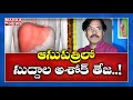 Suddala Ashok Teja admitted to hospital, needs Liver transplantation