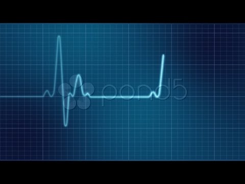 Ekg Heart Monitor
