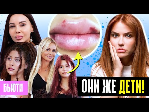 УВЕЛИЧИЛА ГУБЫ РЕБЕНКУ 💋 Самойлова и Борисова делают детей ВЗРОСЛЫМИ !