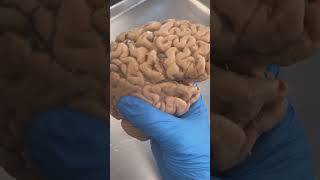 The Brain of an Irrational Person screenshot 5