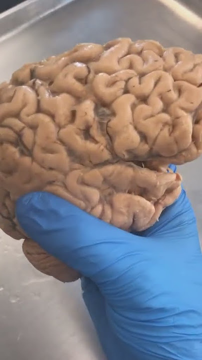 The Brain of an Irrational Person